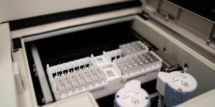 Αιματολογική εξέταση ανιχνεύει το Αλτσχάιμερ σε πρώιμο στάδιο – Η συμβολή του εργαστηρίου Νευροεκφυλιστικών Νοσημάτων του ΑΠΘ