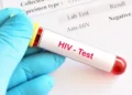 Νέα εποχή στη μάχη με τον ιό HIV: Οι ΗΠΑ ενέκριναν φάρμακο που θα μπορούσε να σταματήσει τη μετάδοση