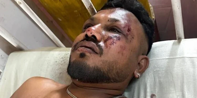 Ο επιβάτης της θέσης 11Α – Αυτός είναι ο μοναδικός επιζών της αεροπορικής τραγωδίας στην Ινδία