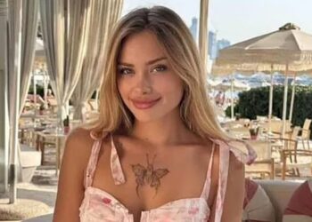 Πάρτι «porta potty»: Σε αμαξίδιο η Ουκρανή influencer – Της λείπουν 10 εκατοστά οστού από το πόδι