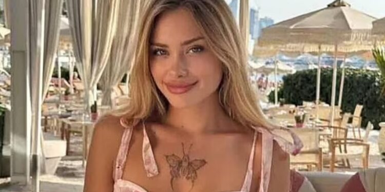 Πάρτι «porta potty»: Σε αμαξίδιο η Ουκρανή influencer – Της λείπουν 10 εκατοστά οστού από το πόδι