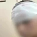 Θεσσαλονίκη: Σοκάρει ο πατέρας του 13χρονου που έπεσε θύμα ξυλοδαρμού – «Είναι γεμάτος τρύπες 15 πόντων στο κεφάλι»
