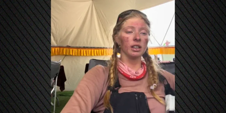 Σοκαριστικό βίντεο: 17χρονη έμεινε 4 μέρες στη Ζώνη Θανάτου του Έβερεστ – Δείτε σε τι κατάσταση γύρισε