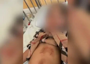 Χαλκιδική: Βίντεο με τον λύκο που επιτέθηκε και τραυμάτισε ένα 5χρονο κοριτσάκι (Βίντεο)