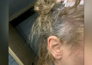 «Της κοπάνησε το κεφάλι στο τιμόνι»: Σήμερα δικάζεται ο πλαστικός χειρουργός που ξυλοκόπησε τη 42χρονη οδηγό