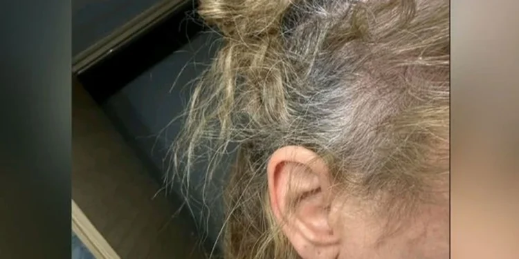 «Της κοπάνησε το κεφάλι στο τιμόνι»: Σήμερα δικάζεται ο πλαστικός χειρουργός που ξυλοκόπησε τη 42χρονη οδηγό