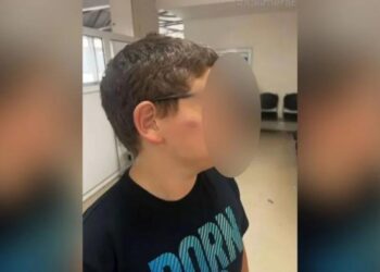 Θεσσαλονίκη: Άγριο ξύλο σε 11χρονο στο σχολείο του – Συγκλονίζει η μητέρα του