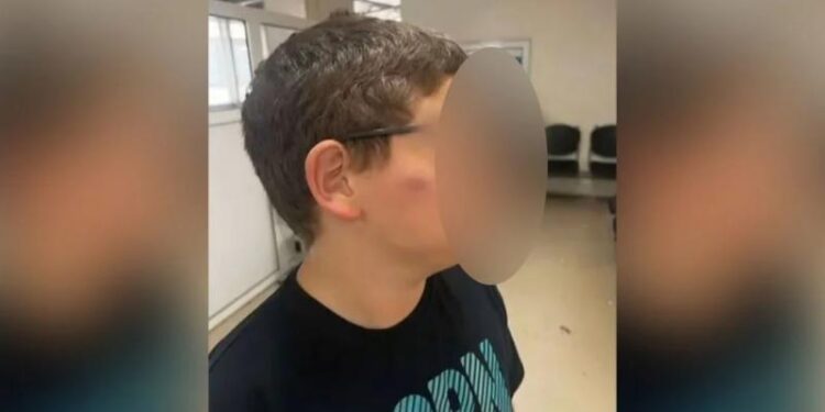 Θεσσαλονίκη: Άγριο ξύλο σε 11χρονο στο σχολείο του – Συγκλονίζει η μητέρα του