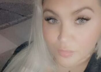 Βρετανίδα μητέρα δύο παιδιών πέθανε μετά από πλαστική επέμβαση στην Τουρκία