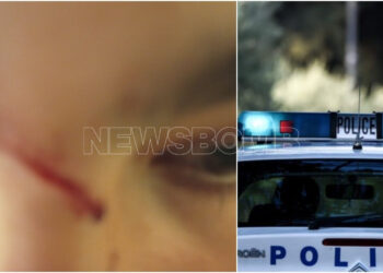 Αχαρνές: 16χρονος αντιστάθηκε σε ληστεία και τον χάραξαν με φαλτσέτα – «Φοβάται», λέει ο πατέρας του