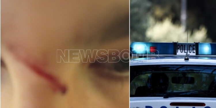 Αχαρνές: 16χρονος αντιστάθηκε σε ληστεία και τον χάραξαν με φαλτσέτα – «Φοβάται», λέει ο πατέρας του