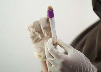 Ελπίδα για έγκαιρη διάγνωση: Τεστ αίματος εντοπίζει βλάβες στο ήπαρ πριν εξελιχθούν σε καρκίνο