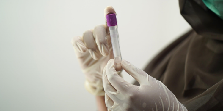 Ελπίδα για έγκαιρη διάγνωση: Τεστ αίματος εντοπίζει βλάβες στο ήπαρ πριν εξελιχθούν σε καρκίνο