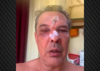Απίστευτο περιστατικό στο Χαϊδάρι: Ξυλοκόπησε άγρια άνδρα μέσα σε ιατρείο όταν του έκανε παρατήρηση να μιλά πιο σιγά στο κινητό