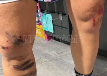 Κρυονέρι: Άγρια επίθεση λύκου σε κάτοικο – «Πάλευα για τη ζωή μου 8 λεπτά»